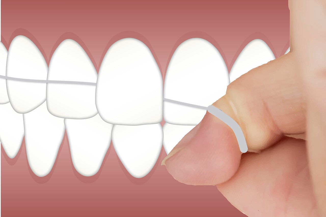 Ankara İnvisalign Klinik - Invisalign Tedavisiyle Elde Edilen Sonuçların Uzun Ömürlü Olması İçin 5 İpucu 