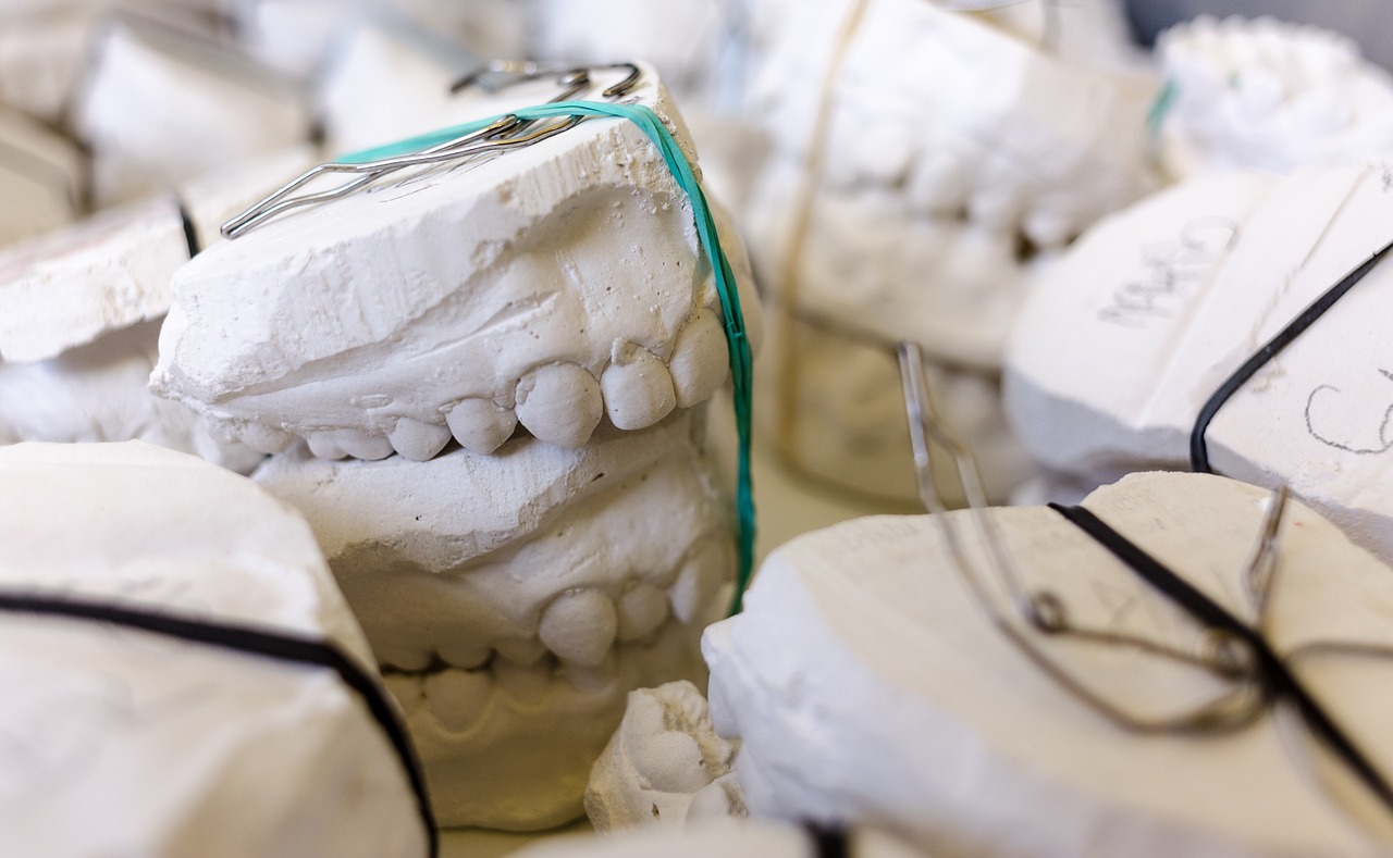 Ankara Ortodonti Kliniği - Invisalign Nedir?