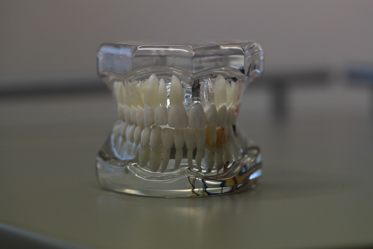 Ankara İnvisalign Doktor - İnvisalign Tedavisinde Kullanılan Ölçüm ve İndeksler