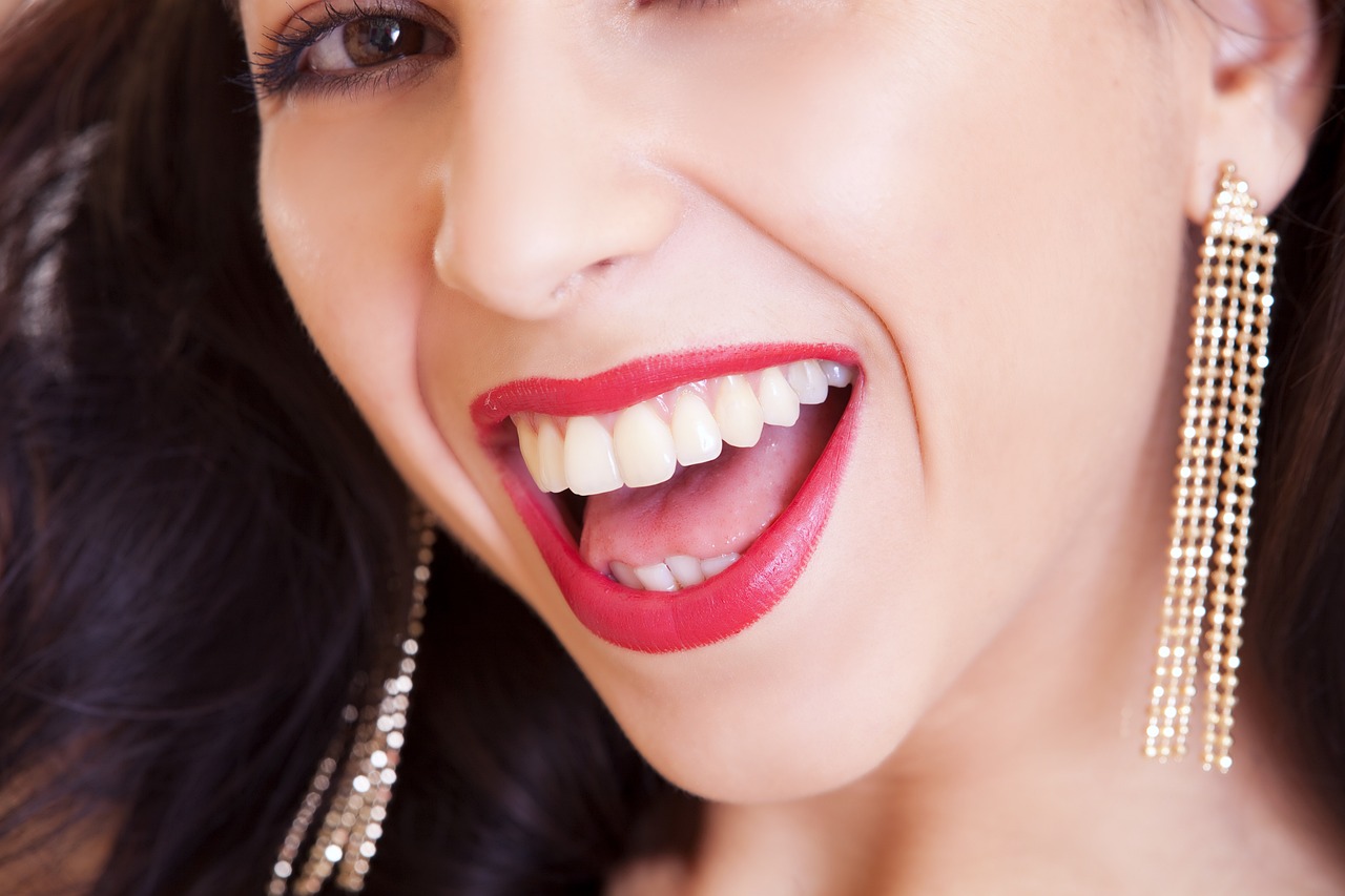 Ankara İnvisalign Tedavi - İnvisalign Nedir?