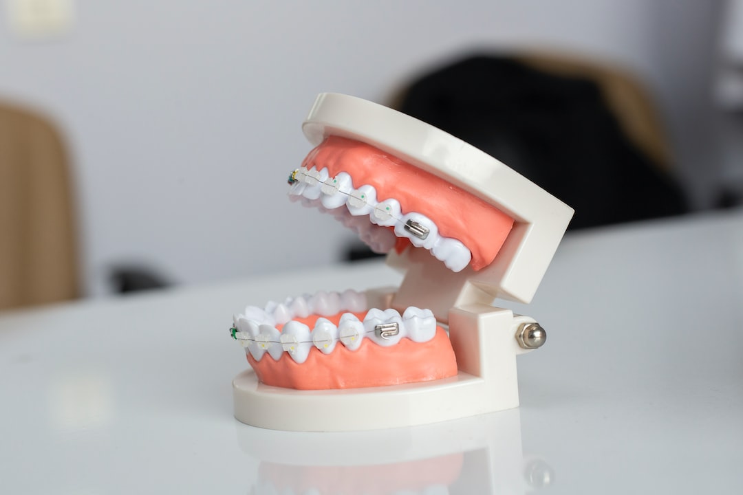 Ankara Ortodonti - İnvisalign Nedir?