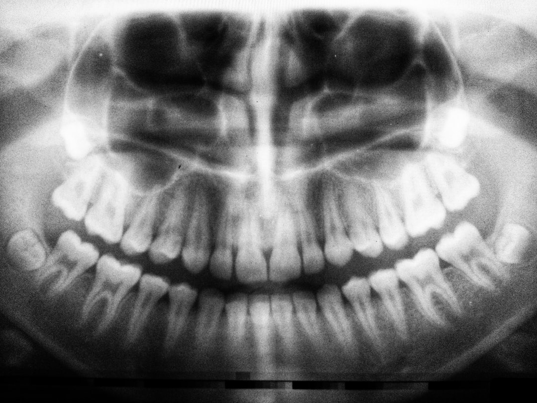 Ankara İnvisalign Doktor - İnvisalign Tedavisinde Ağrıyı Azaltmanın 5 Etkili Yolu