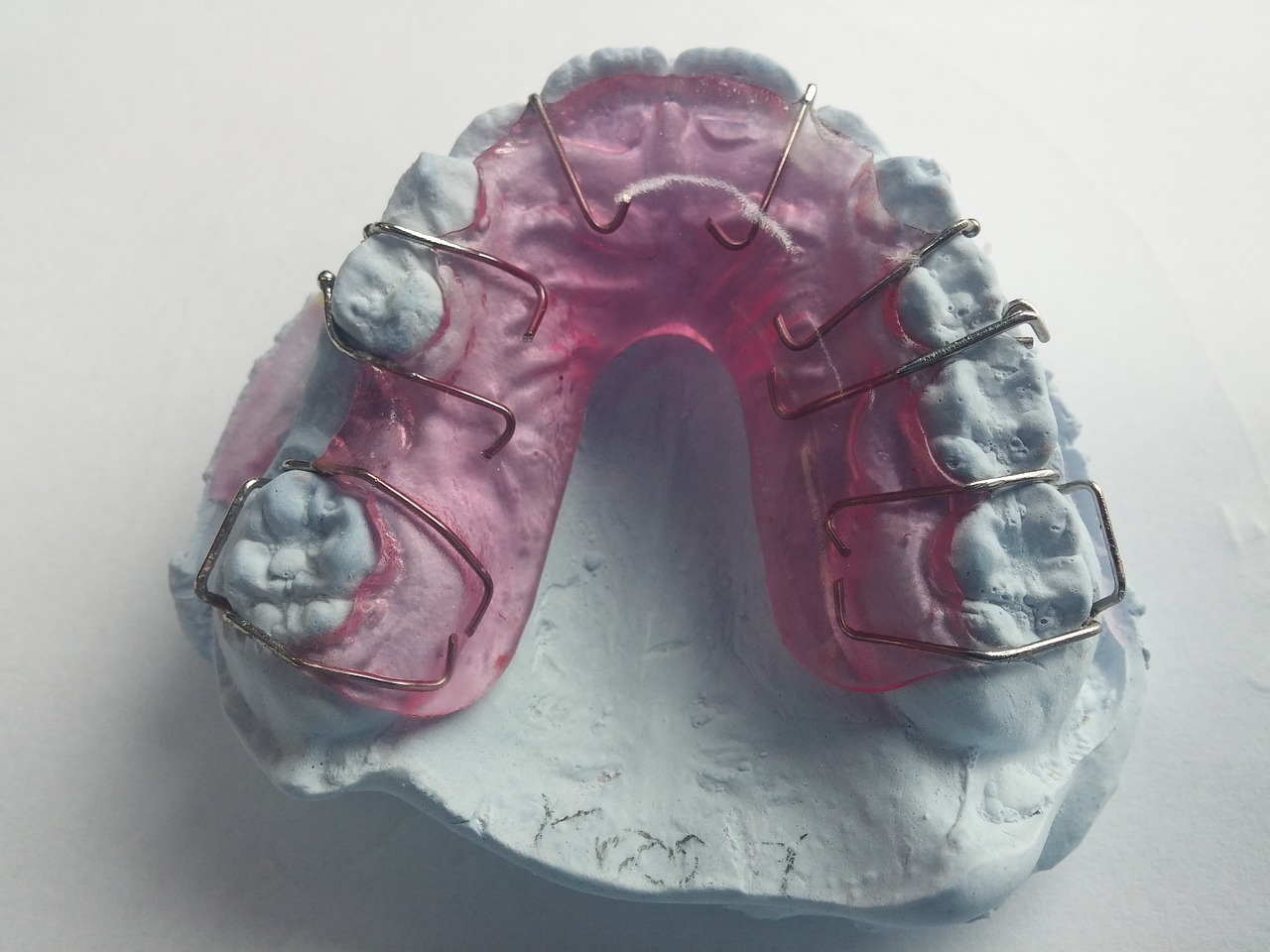 Ankara İnvisalign Doktor -  Yumuşatıcı Tabletlerle Invisalign Plaklarının Doğru Temizlenmesi: Pratik Öneriler 