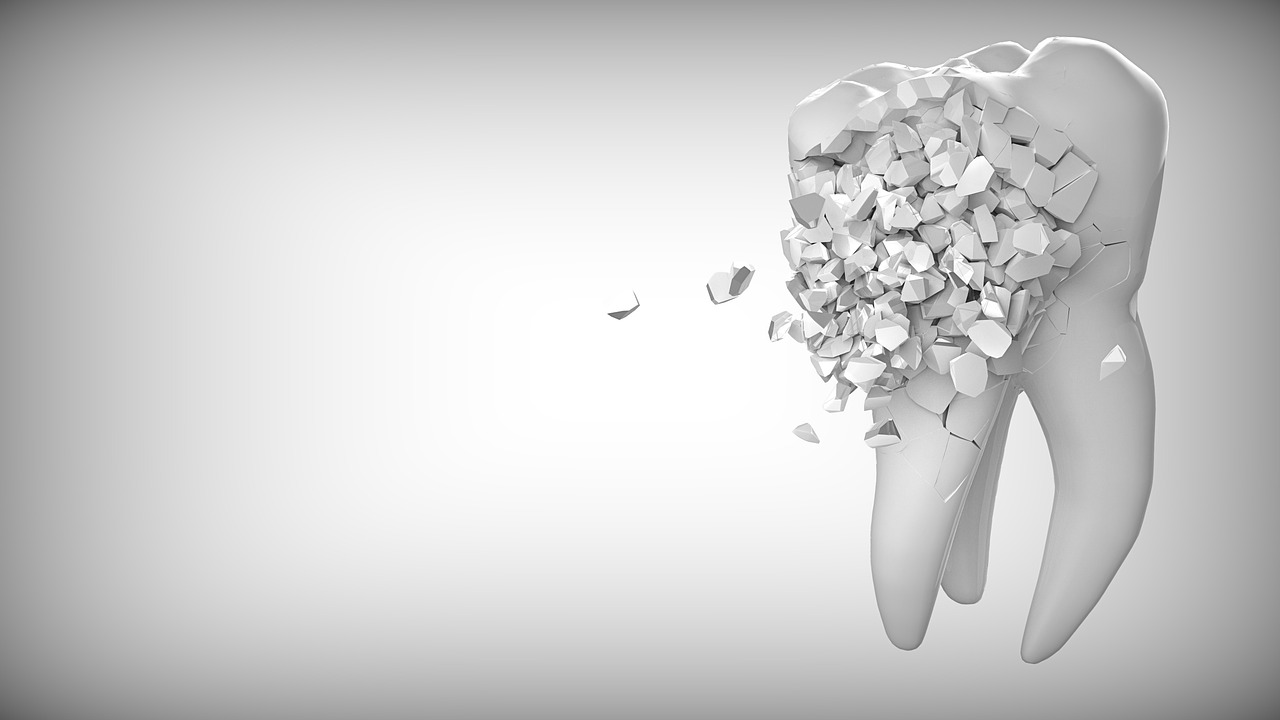 Ankara İnvisalign Tedavi - İnvisalign vs. Metal Tel: Hangisi Daha Konforlu Bir Deneyim Sunar?