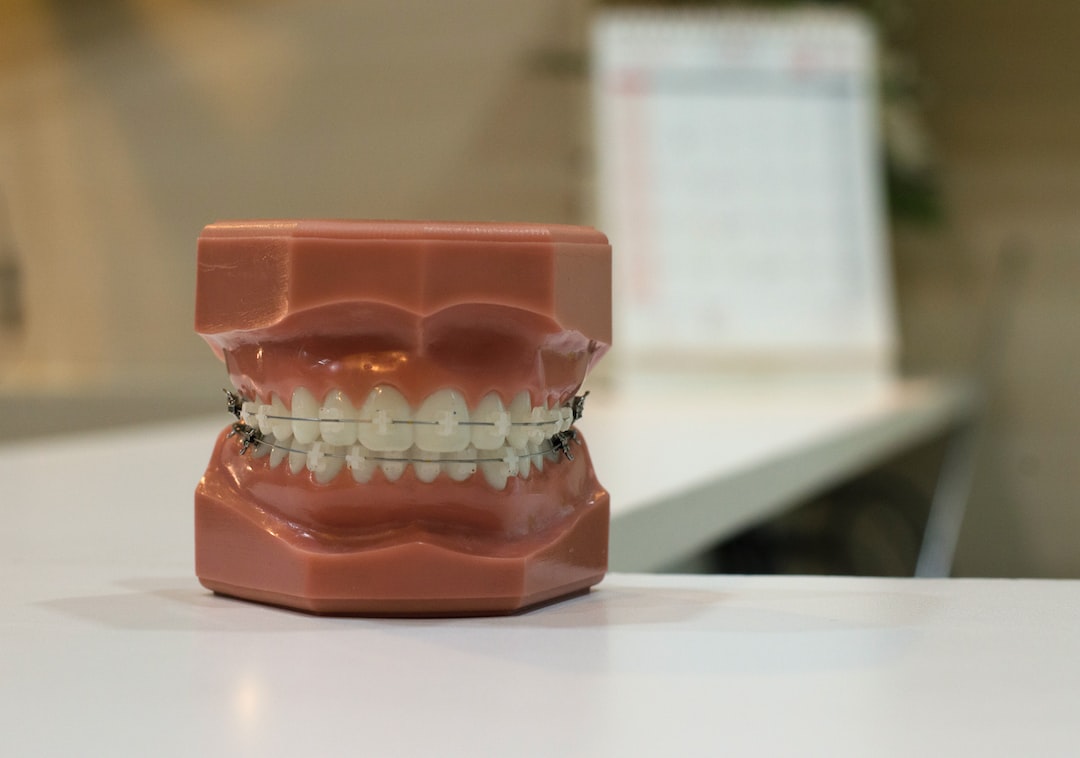 Ankara Ortodonti Uzmanı - İnvisalign Nedir ve Nasıl Çalışır?