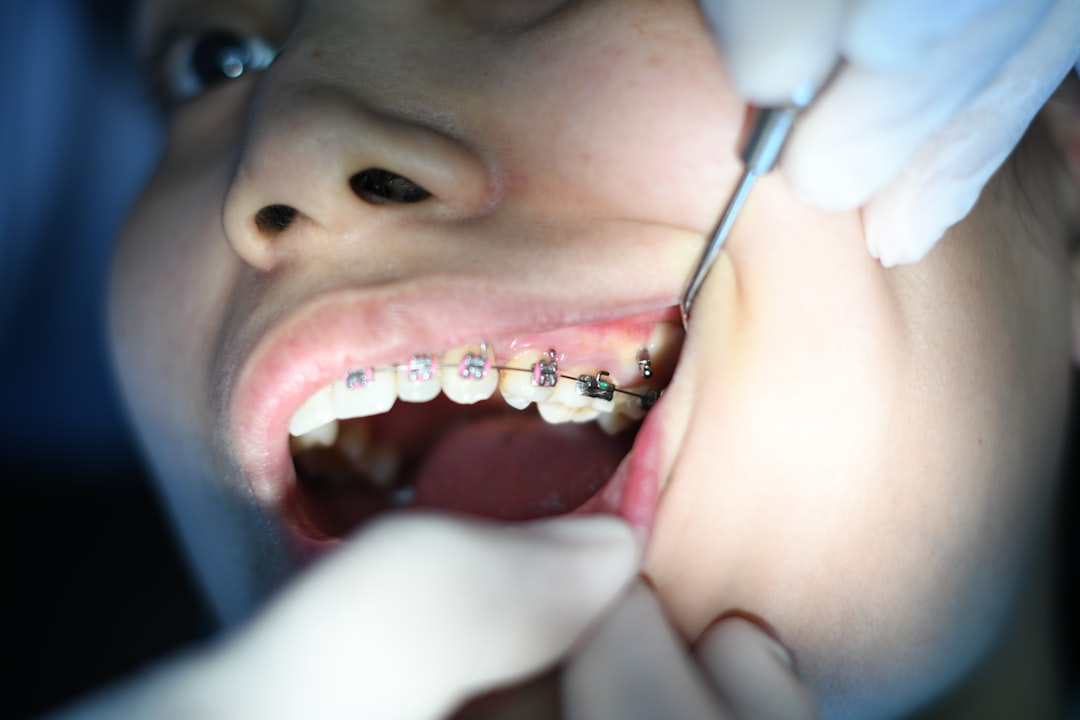 Ankara Şeffaf Plak - Invisalign Tedavisinin Etkileyici Sonuçları: Gerçek Hasta Deneyimleri