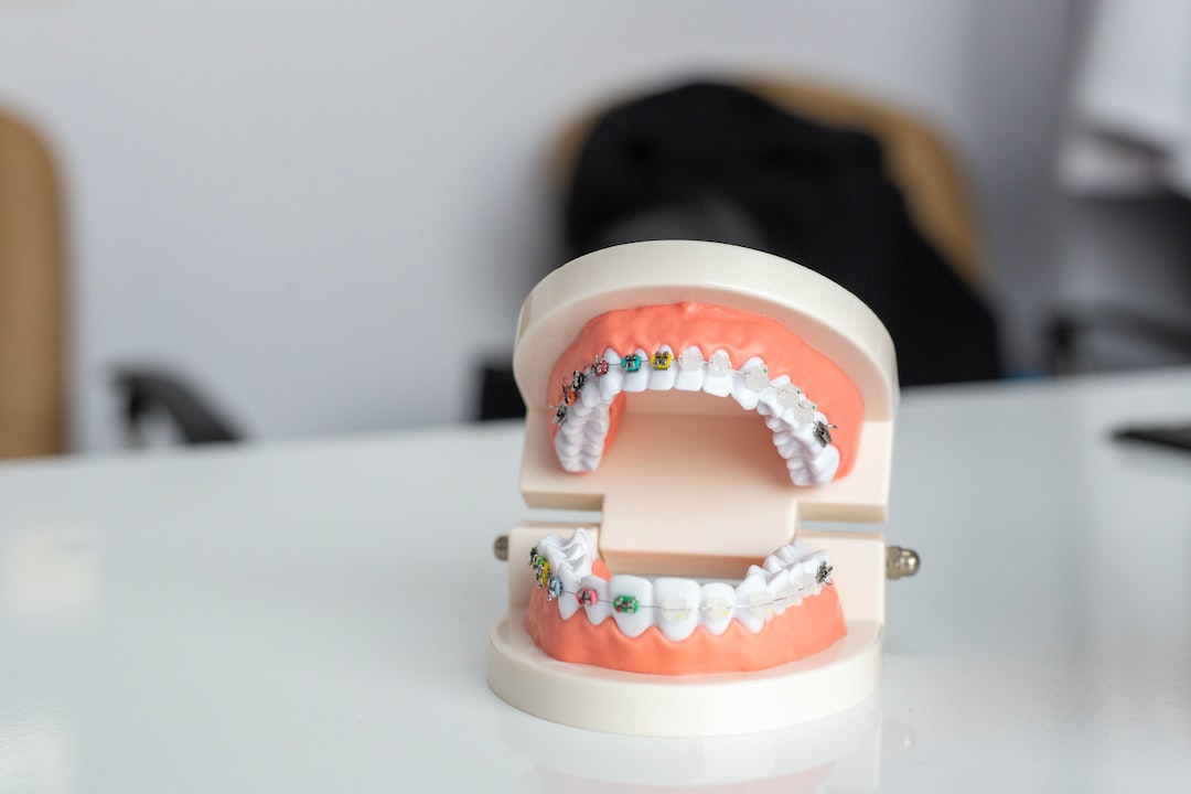 Ankara İnvisalign Doktor -  İnvisalign Plaklarının Temizlenmesi 