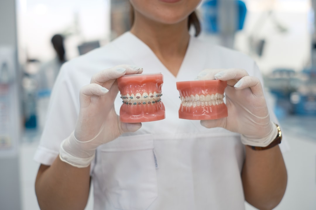 Ankara İnvisalign Klinik - Invisalign ile Lingual Braketler Arasındaki Farklar: Hangisi Daha Günlük Hayata Uyum Sağlar?