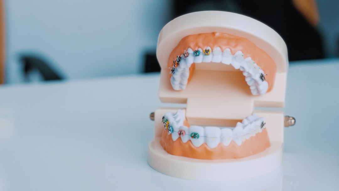 Ankara İnvisalign Klinik - Diş Fırçalama ve Diş İpi Kullanımıyla Invisalign Tedavisinde İdeal Ağız Hijyeni