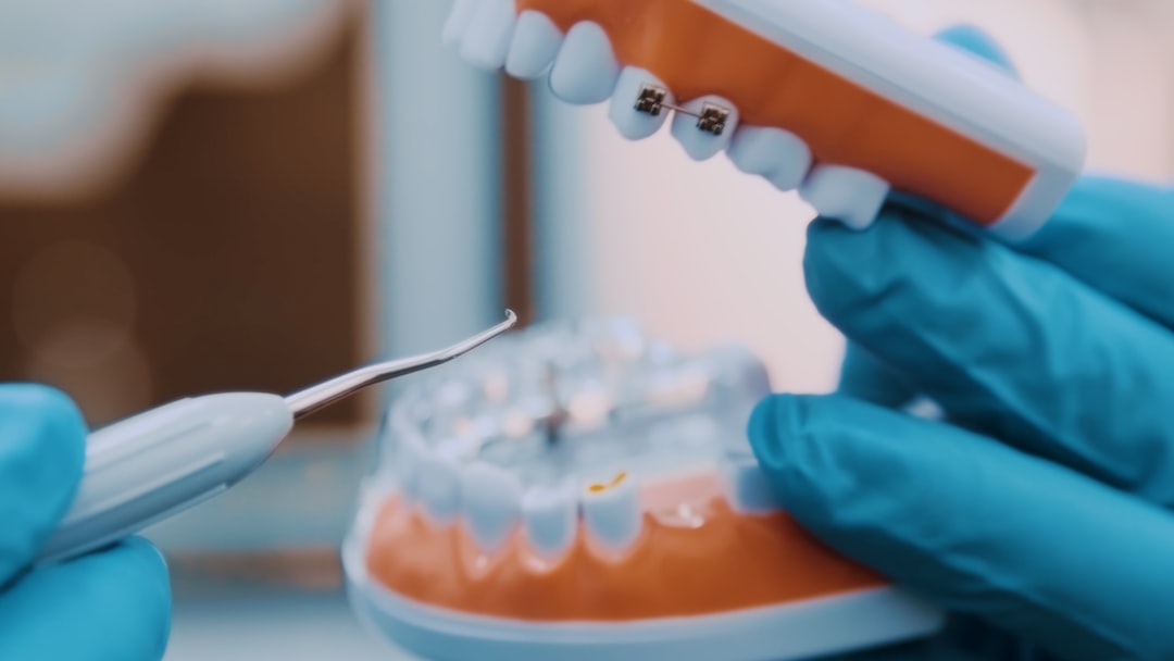 Ankara Ortodonti Uzmanı - Invisalign ve Konuşma Yeteneği