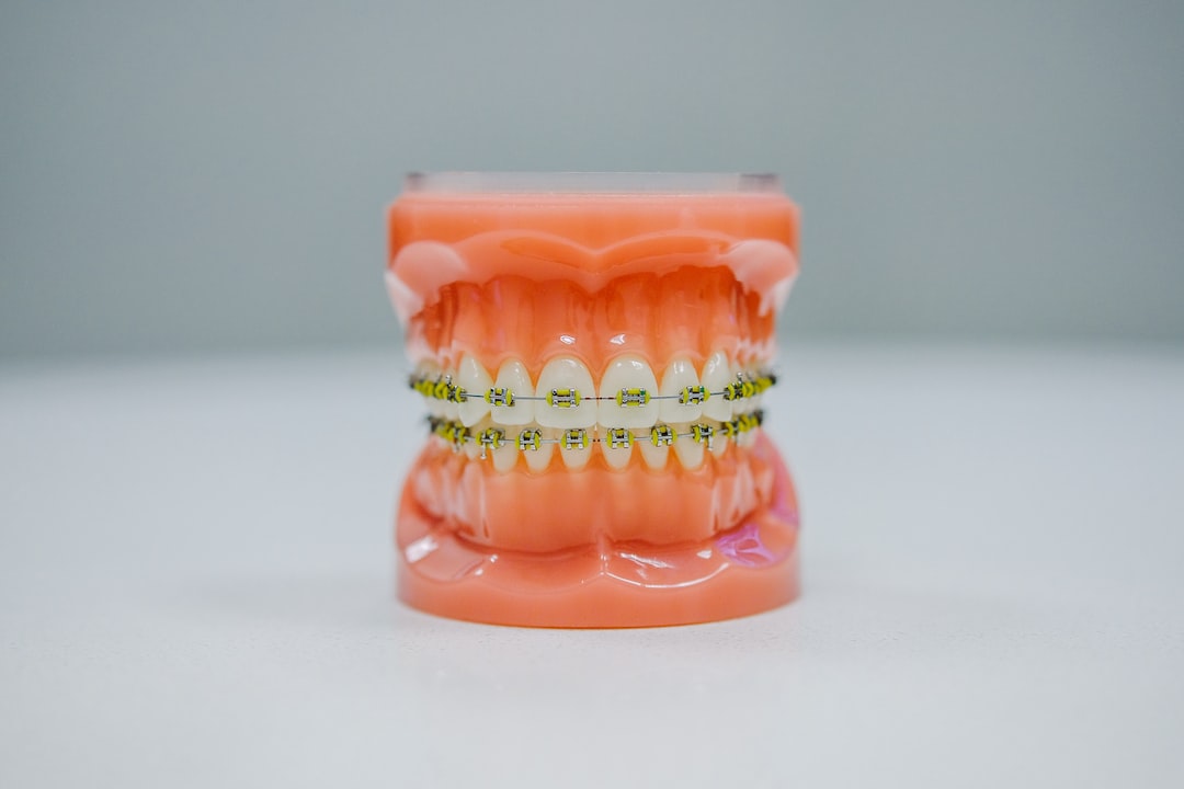 Ankara İnvisalign Doktor - İnvisalign vs. Metal Tel: Hangisi Daha Kolay Ayarlanabilir? 